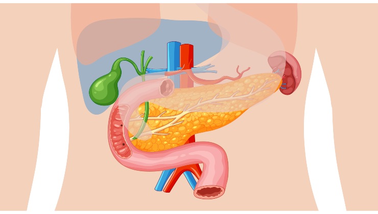 Tumore al pancreas, "non dovete sottovalutare questo sintomo"