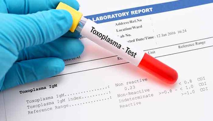 Allarme toxoplasmosi, "in questa città italiana il rischio di prenderla 